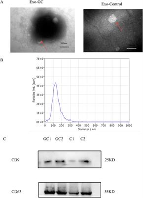 Identification of plasma exosomal lncRNA as a biomarker for early diagnosis of gastric cancer